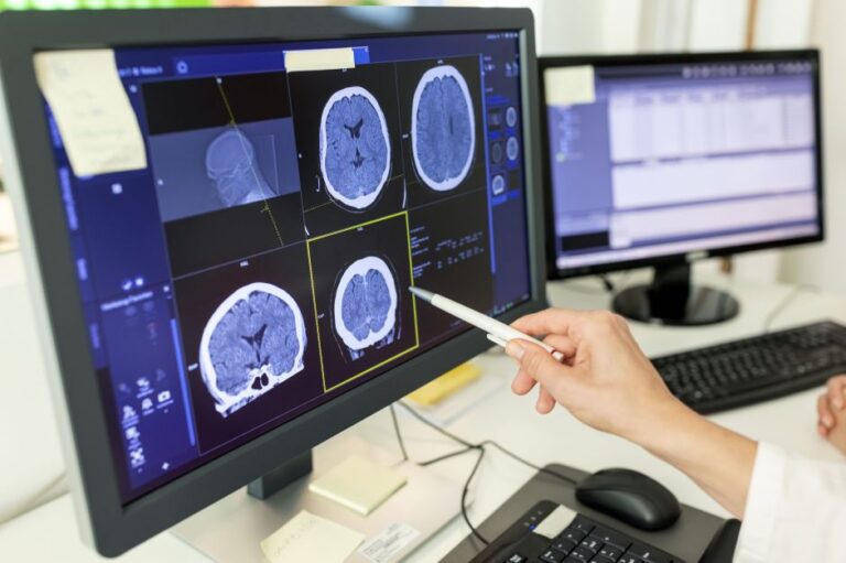 Médicos investigam novos casos após misteriosas infecções cerebrais em crianças nos EUA