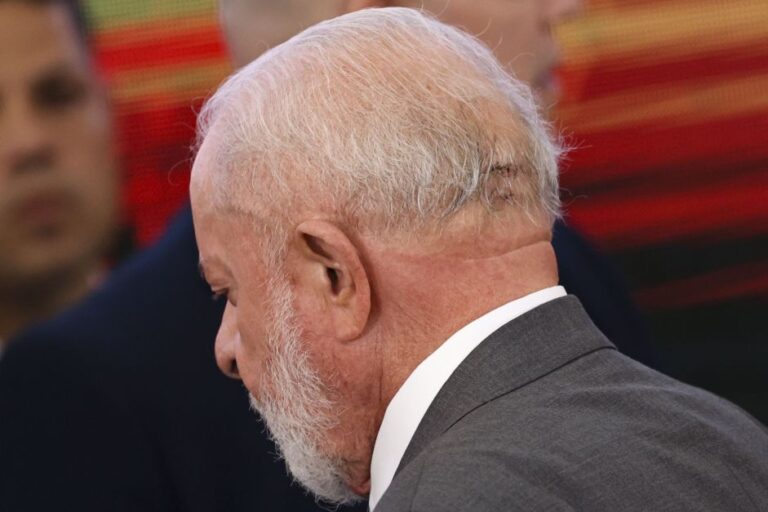 Duas semanas após queda, Lula permanece estável e sem sintomas