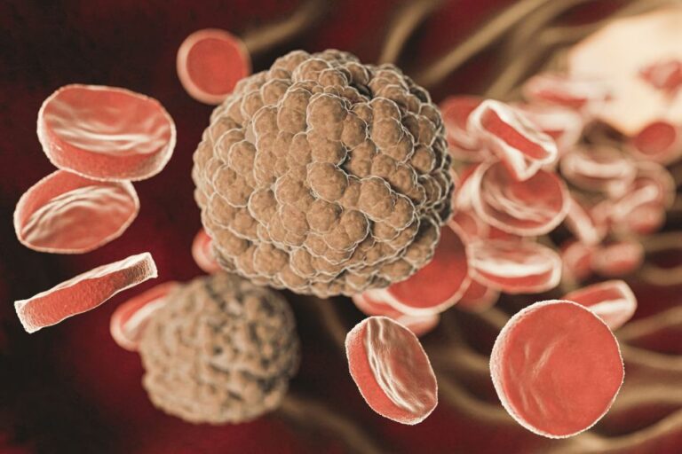 Linfoma de Hodgkin é mais comum em jovens: entenda mitos e verdades sobre eles