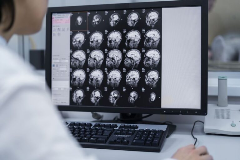 O que é hemorragia intracraniana e quais são as causas? Entenda